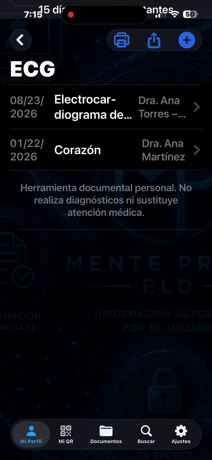 ECG — lista