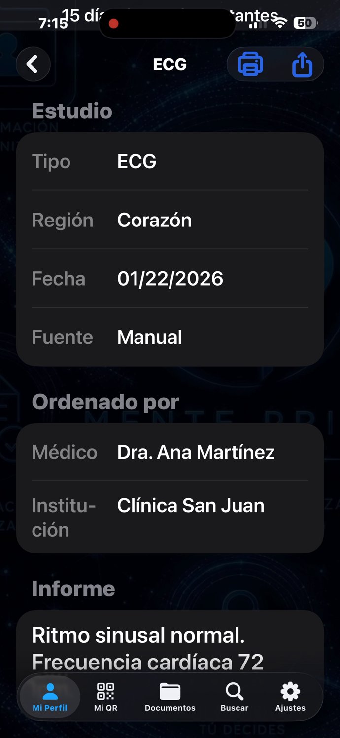 ECG — detalle de un estudio